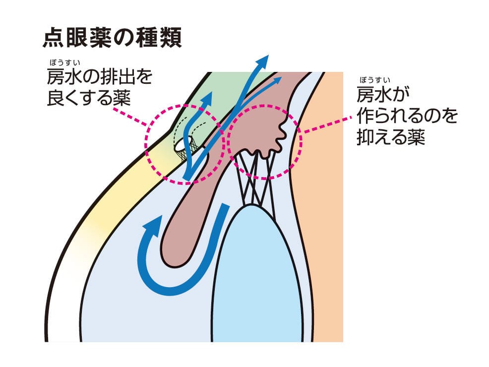 点眼治療